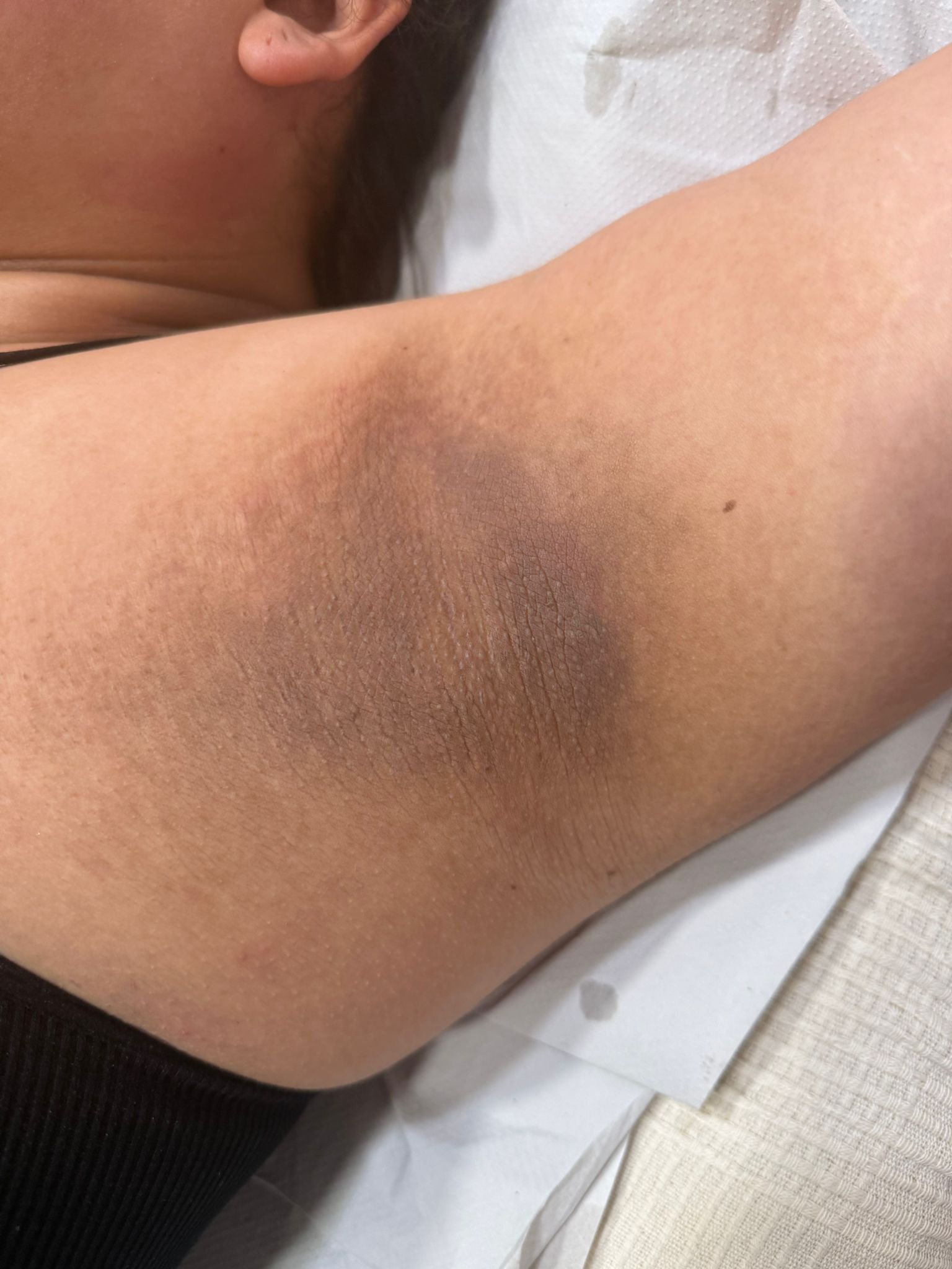 Antes y después OnFace